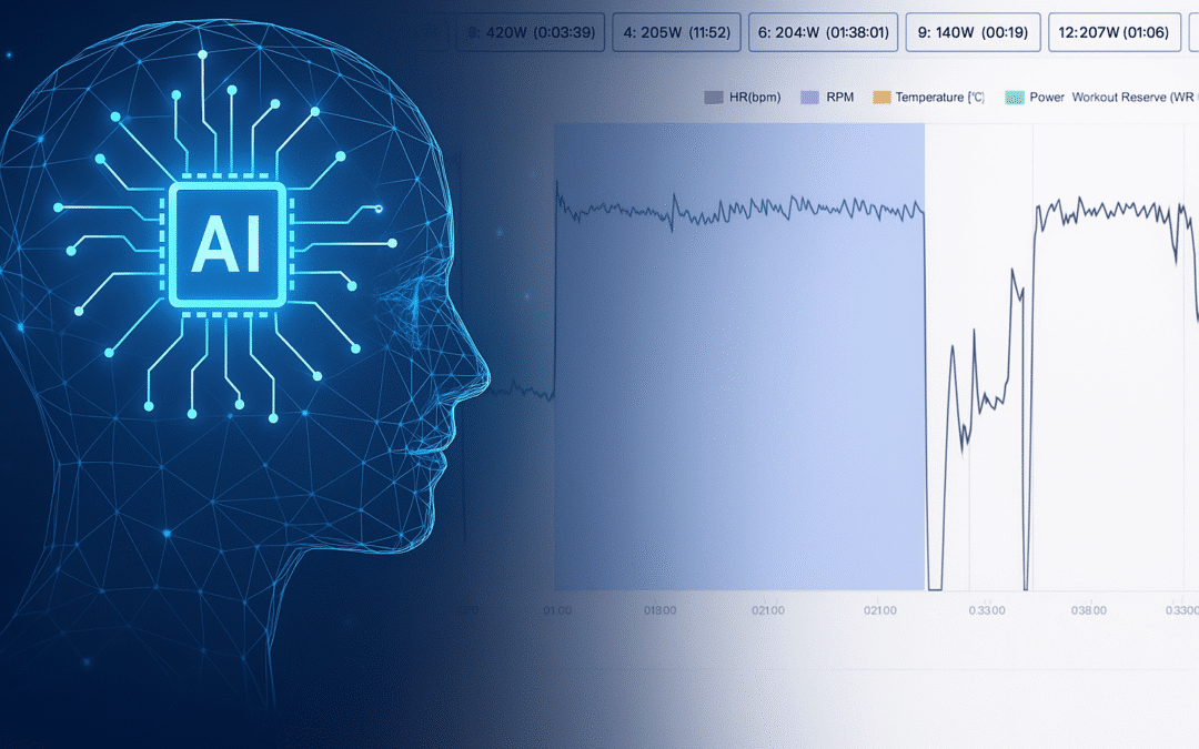 Interval IQ™: Automatic Interval Detection